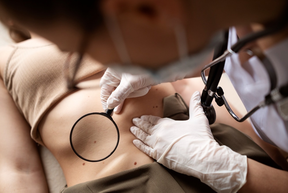 skin cancer check Australia